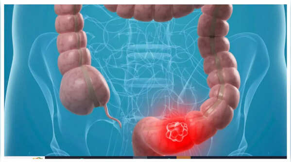 Abdominal pain and discomfort